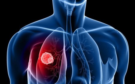 لمرضى السرطان.. اليكم هذه البشرى