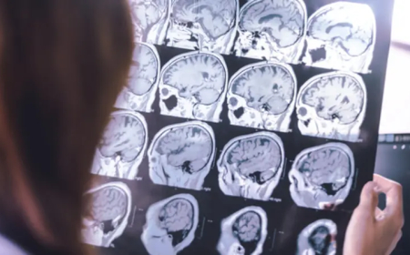 فائدة جديدة لخفض الكوليسترول.. اليكم ما يحصل