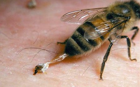 "سم النحل" لمحاربة التجاعيد