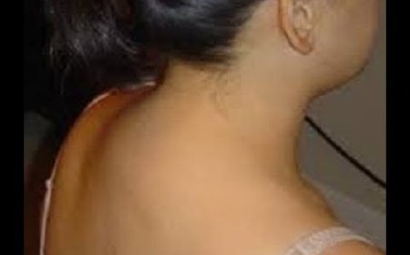 كيف نتخلص من حدبة الرقبة المزعجة؟