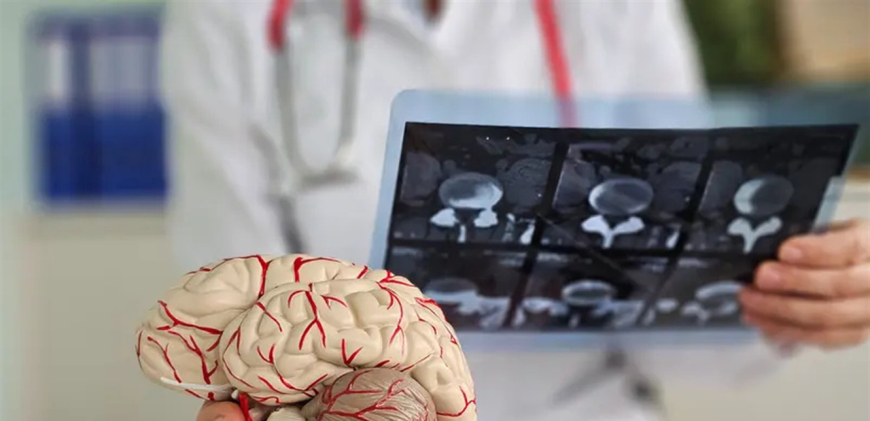 أدمغة الرجال مختلفة عن أدمغة النساء.. اليكم السبب