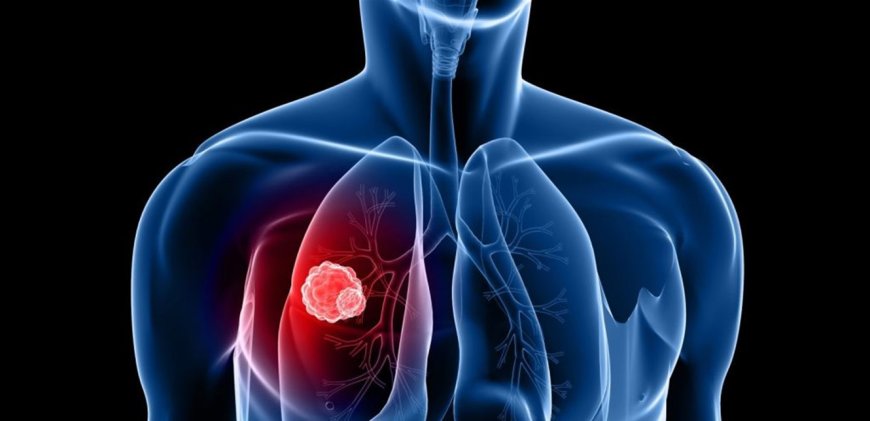 لمرضى السرطان.. اليكم هذه البشرى