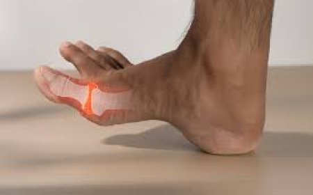 ارتفاع حالات النقرس بين الشباب.. ودراسة تكشف الأسباب