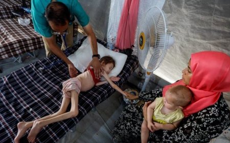 100 الف طفل في غزة مهددون بسوء التغذية