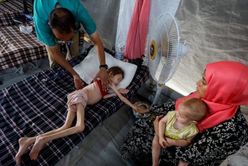 100 الف طفل في غزة مهددون بسوء التغذية