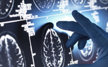 كيف نبطىئ تدهور الذاكرة لدى مرضى الزهايمر؟