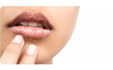 كيف تتجنب جفاف الفم في رمضان؟