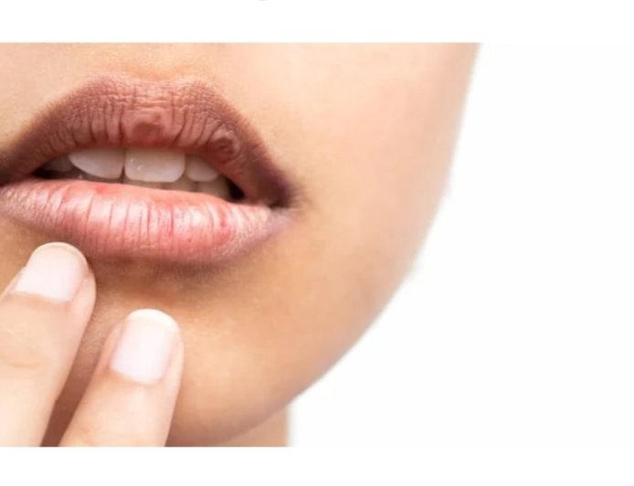 كيف تتجنب جفاف الفم في رمضان؟