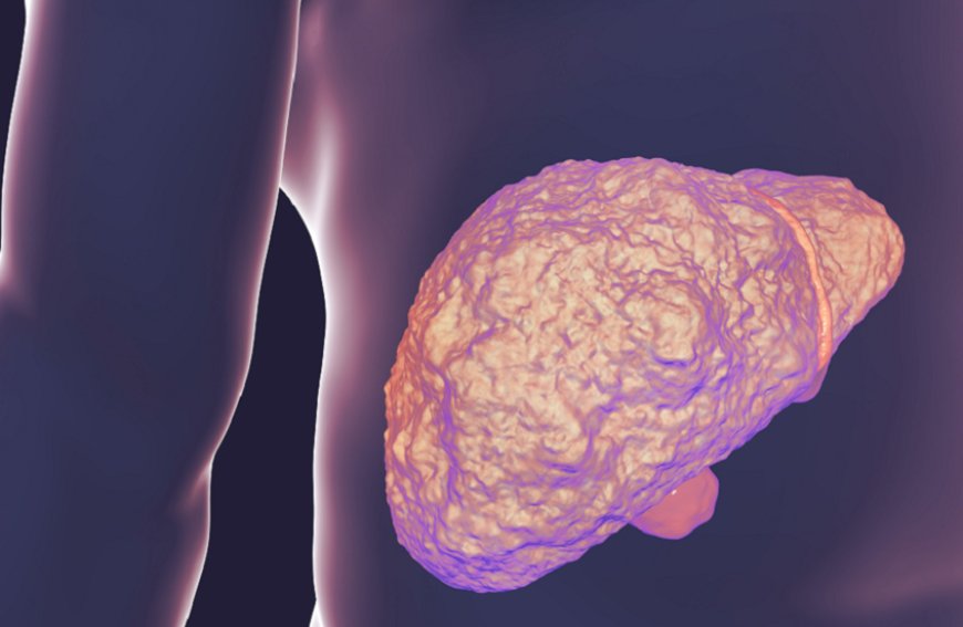 تحذير لمرضى الكوليسترول.. "كبدكم في خطر"