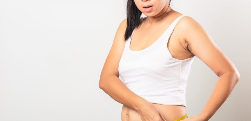 كيف تتخلص الحوامل من وزن ما بعد الولادة؟