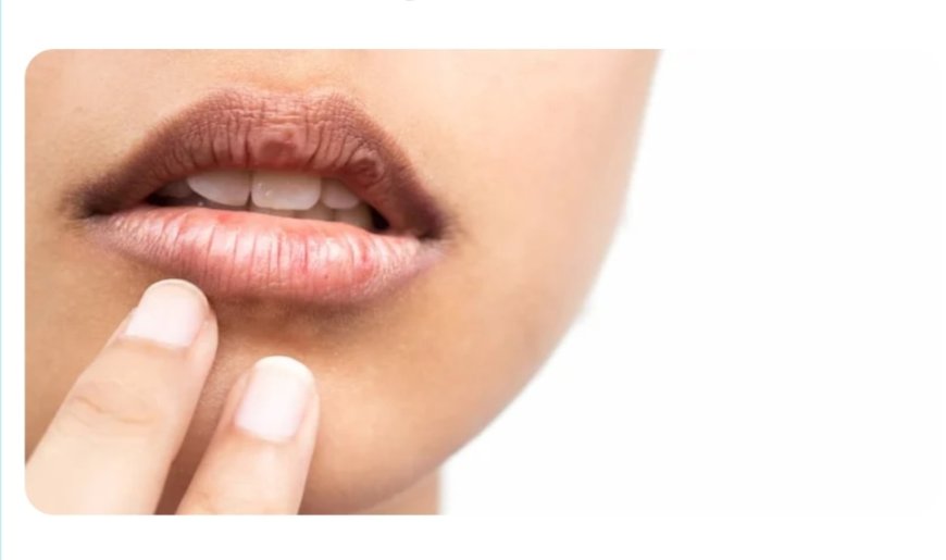 كيف تتجنب جفاف الفم في رمضان؟