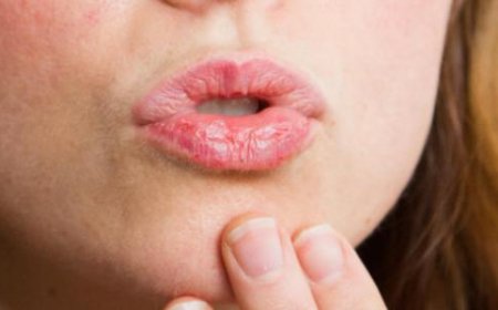 تشقق الشفاه في شهر رمضان.. اليكم الحلول