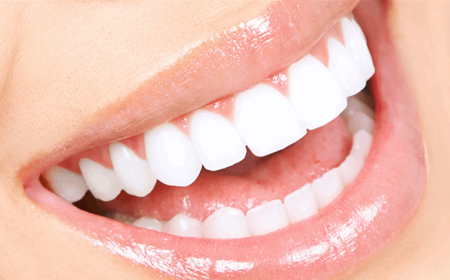 أطعمة يومية قد تمنحك أسنانًا أكثر بياضًا… لكن هذا الشرط أساسي!