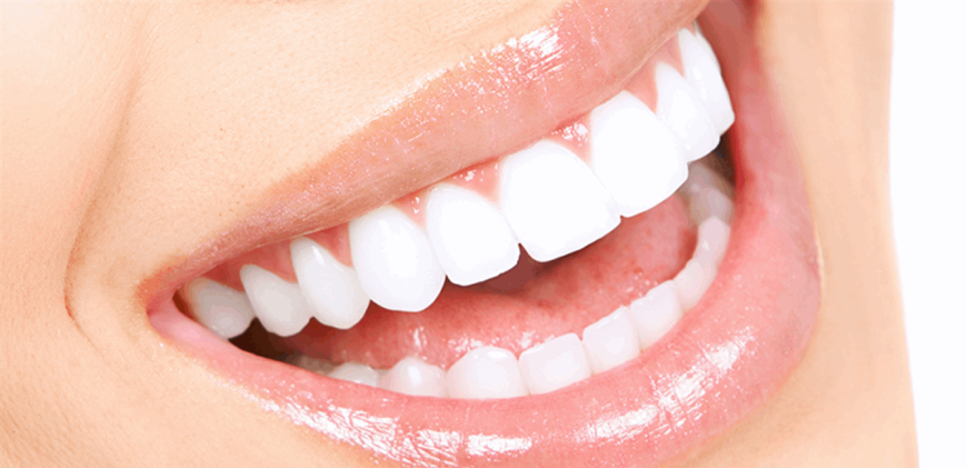 أطعمة يومية قد تمنحك أسنانًا أكثر بياضًا… لكن هذا الشرط أساسي!